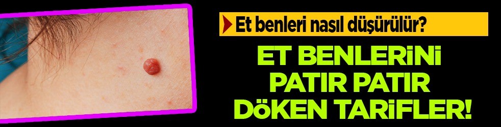 Et benlerini patır patır döken tarifler! Et benleri nasıl düşürülür? Çözüm püf noktasında