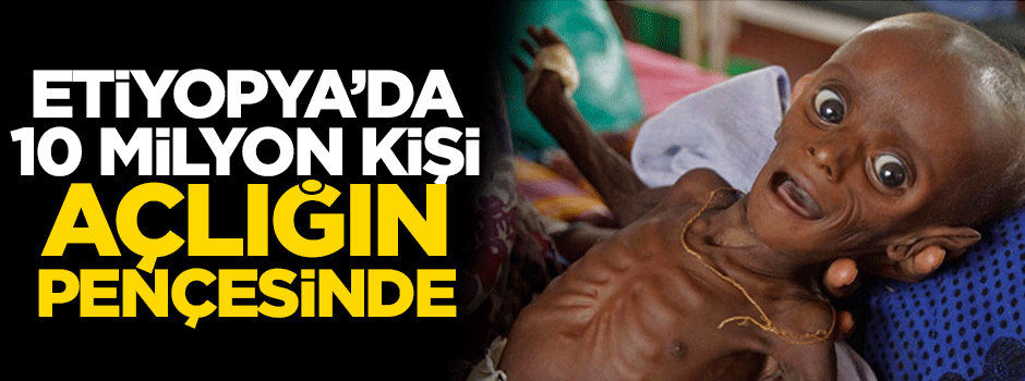 Etiyopya’da 10 milyon kişi açlığın pençesinde