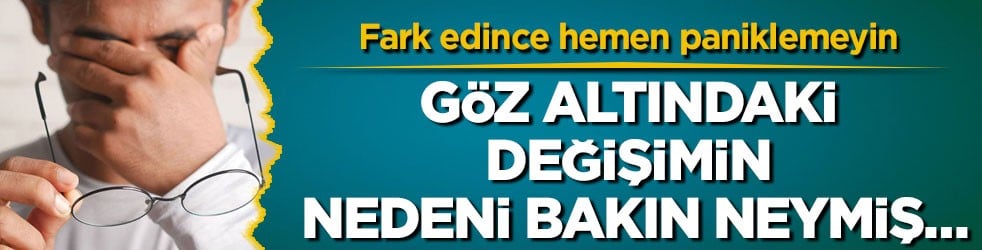 Fark edince hemen paniklemeyin! Göz altındaki değişimin nedeni bakın neymiş…