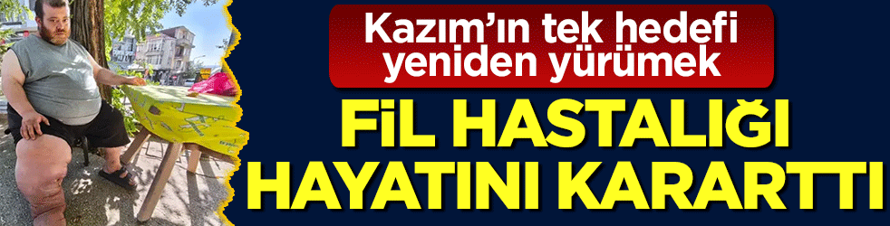 Fil hastalığı hayatını kararttı! Kazım’ın tek hedefi yeniden yürümek