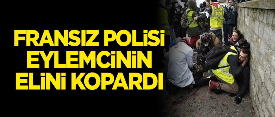 Fransız polisi eylemcinin elini kopardı