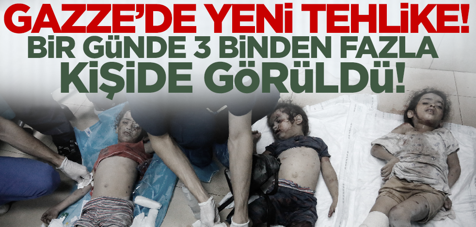 Gazze için yeni tehlike! Bir günde 3 binden fazla kişide görüldü