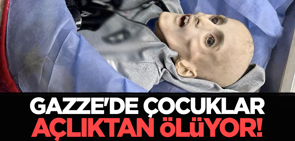 Gazze'de çocuklar açlıktan ölüyor!