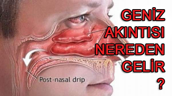 Geniz akıntısı nereden gelir?