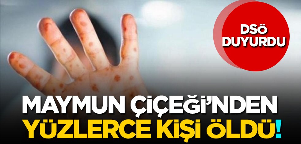 Gerçek vaka ve ölüm sayısı yüksek! DSÖ, 'maymun çiçeği'nden yüzlerce kişinin öldüğü resmen raporlandı!