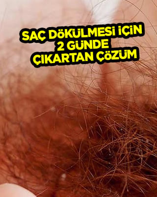 Gerçekten çok şaşırttı! Saç dökülmesi için 2 günde saç çıkartan çözüm ne diye soranlar: Onlarla durdur