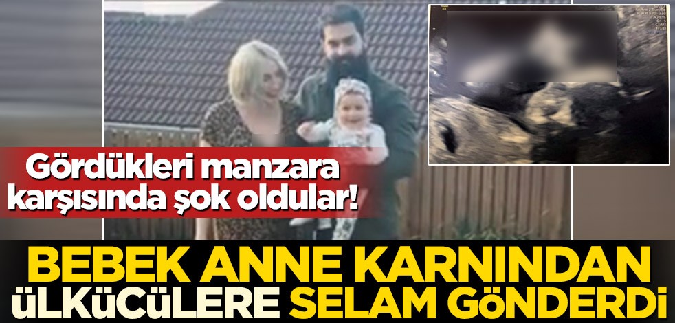 Gördükleri manzara karşısında şok oldular! O bebek anne karnından ülkücülere selam gönderdi