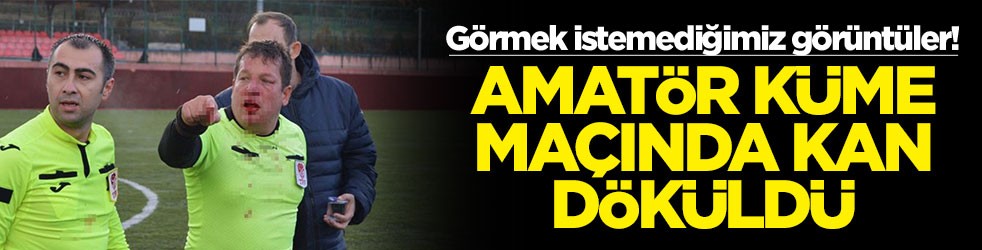 Görmek istemediğimiz görüntüler! Amatör küme maçında kan döküldü