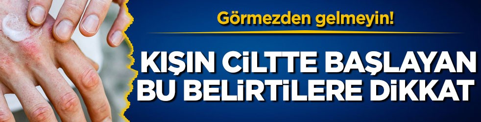 Görmezden gelmeyin! Kışın ciltte başlayan bu belirtilere dikkat