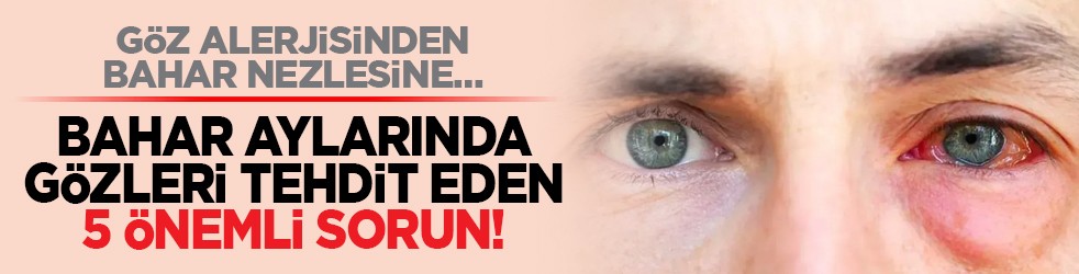 Göz alerjisinden bahar nezlesine… Bahar aylarında gözleri tehdit eden 5 önemli sorun!