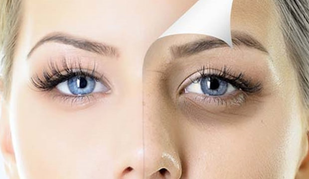 Göz altı morluklarına son! Bu maske kararmaları yok edecek