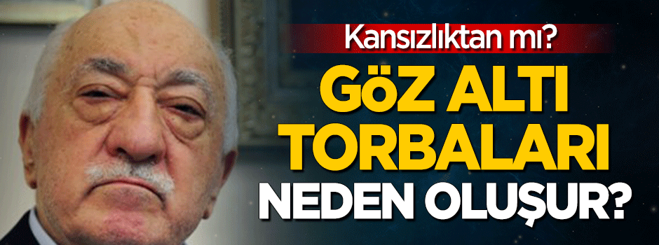 Göz altı torbaları neden oluşur?