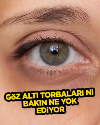  Göz altı torbaları ve morluklardan bir günde kurtulmak ister misiniz?