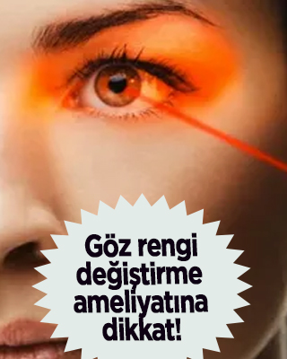 Göz hastalıkları uzmanı uyardı: Göz rengi değiştirme ameliyatına dikkat