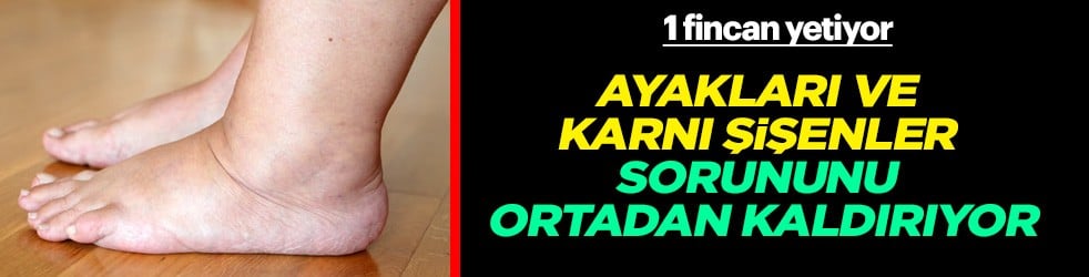 Günde 1 fincan mısır püskülü, ayakları ve karnı şişenler için birebir! Küçük miktarda ekleyin, uyku bozar 