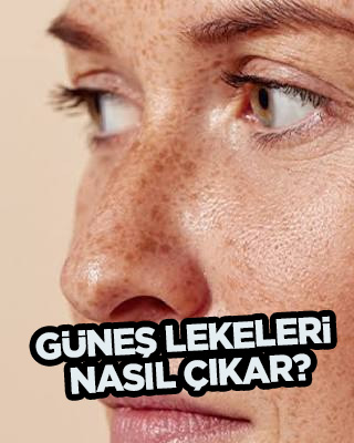 Güneş lekeleri nasıl çıkar? Bu yöntemin amacı lekelerden kurtulmak