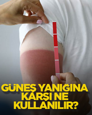 Güneş yanığına karşı ne kullanılır?