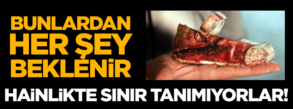 Hainlikte sınır tanımıyorlar!