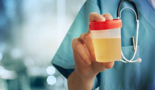 Hangi idrar rengi, hangi hastalığın habercisi?