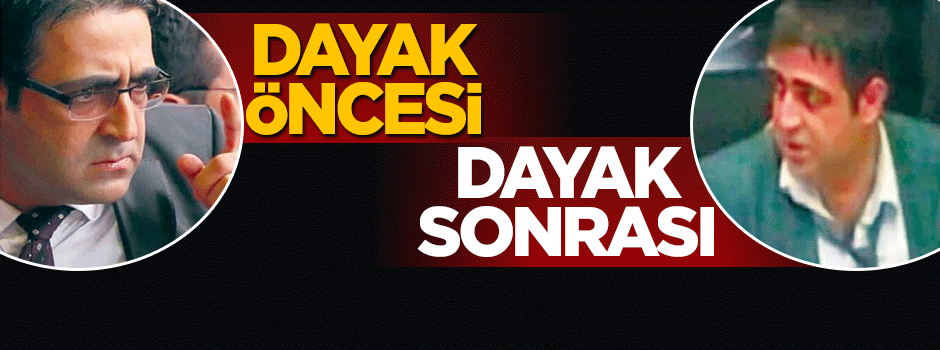 HDP'li vekilin dokunulmazlıktan önce ve sonraki hali!