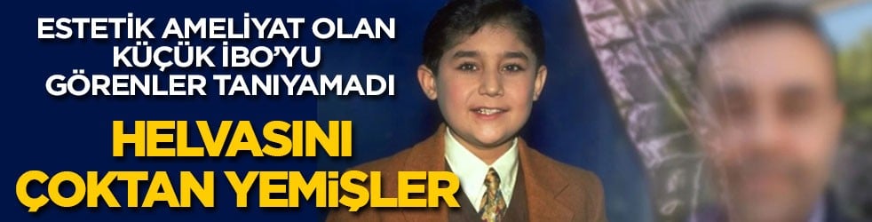 Helvasını çoktan yemişler! Küçük İbo estetik ameliyatla bambaşka birine dönüştü
