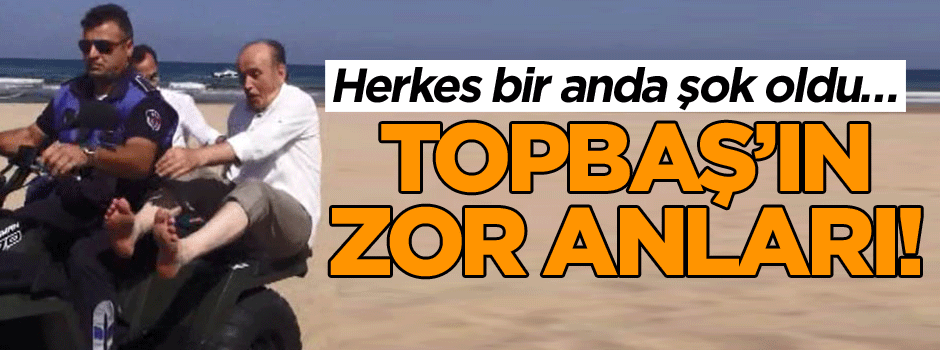 Herkes bir anda şok oldu… Topbaş’ın zor anları!