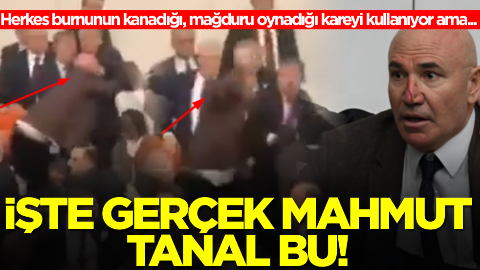 Herkes burnunun kanadığı, mağduru oynadığı fotoğrafı kullanıyor ama...! İşte gerçek Mahmut Tanal bu