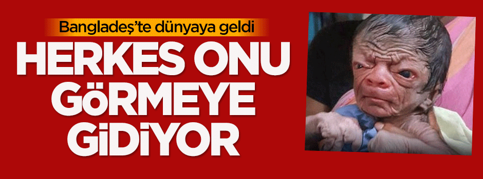 Herkes o bebeği görmeye gidiyor