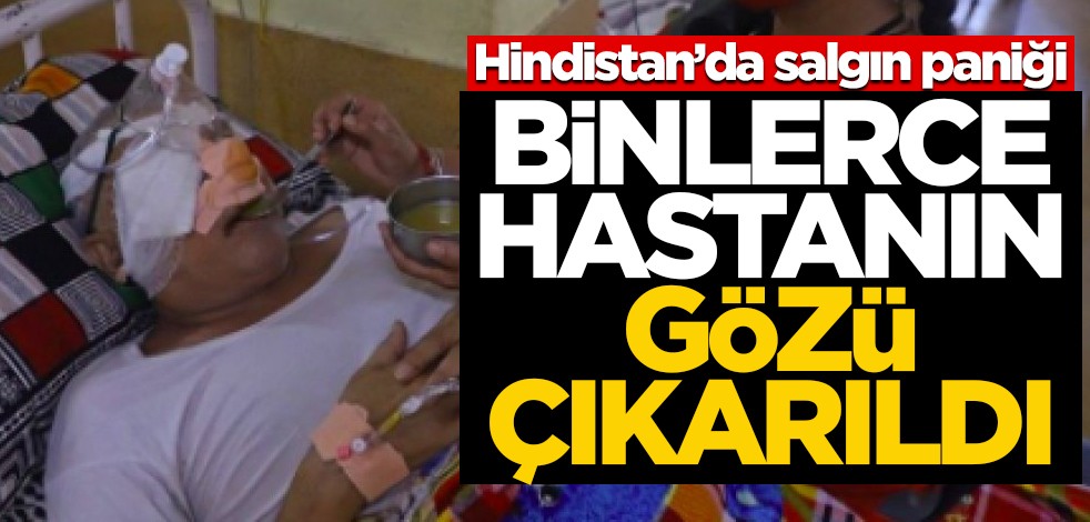 Hindistan'da salgın paniği! Binlerce hastanın gözü çıkarıldı!