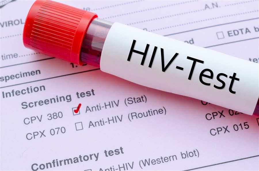 HIV testi hangi bölümde yapılır?