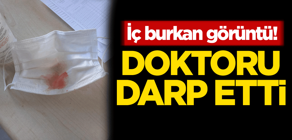İç burkan görüntü! Doktoru darp etti