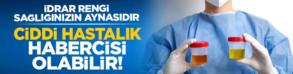 İdrar rengi sağlığınızın aynasıdır: Ciddi hastalık habercisi olabilir!