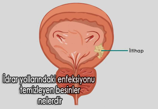 İdrar yollarındaki enfeksiyonu temizleyen besinler