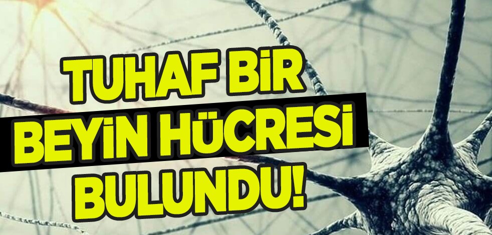 İki yüzlü beyin hücrelerinin olduğu iddia edilmişti, doğrulandı: Sonuç almak için devam..! Bakın detaylar ne!