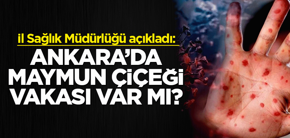 İl Sağlık Müdürlüğü açıkladı: Ankara’da maymun çiçeği vakası var mı?