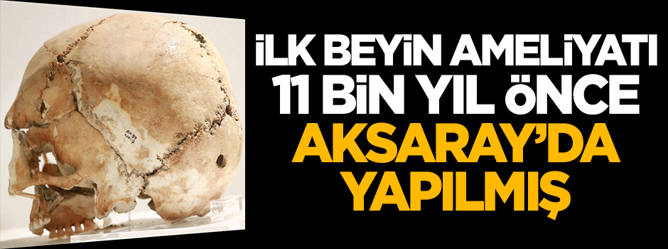 İlk beyin ameliyatı 11 bin yıl önce Aksaray'da yapılmış