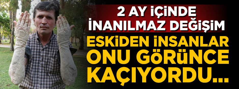 İnanılmaz değişim! Eskiden insanlar ondan kaçıyordu, şimdi ise...