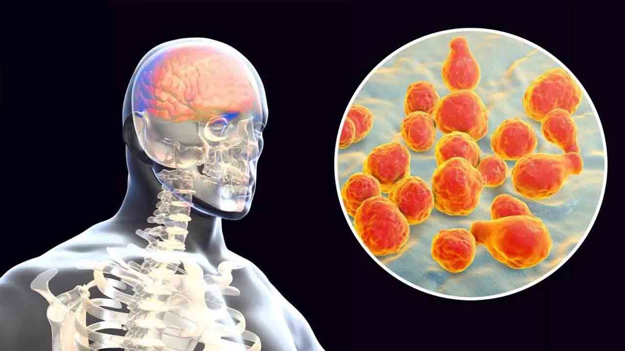 İngiltere’de menenjit alarmı: 2 genç hayatını kaybetti
