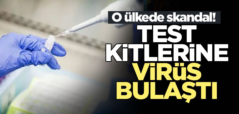 İngiltere'de test kitlerine virüs bulaştığı iddia edildi