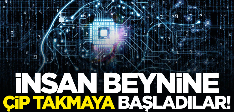 İnsan beynine çip takma denemeleri başladı