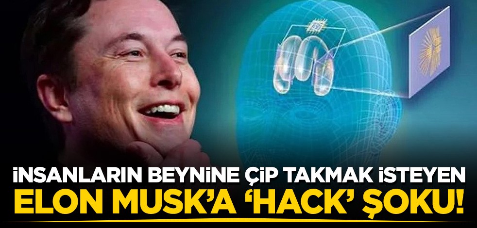 İnsanların beynine çip takmak isteyen Elon Musk'a 'hack' şoku!