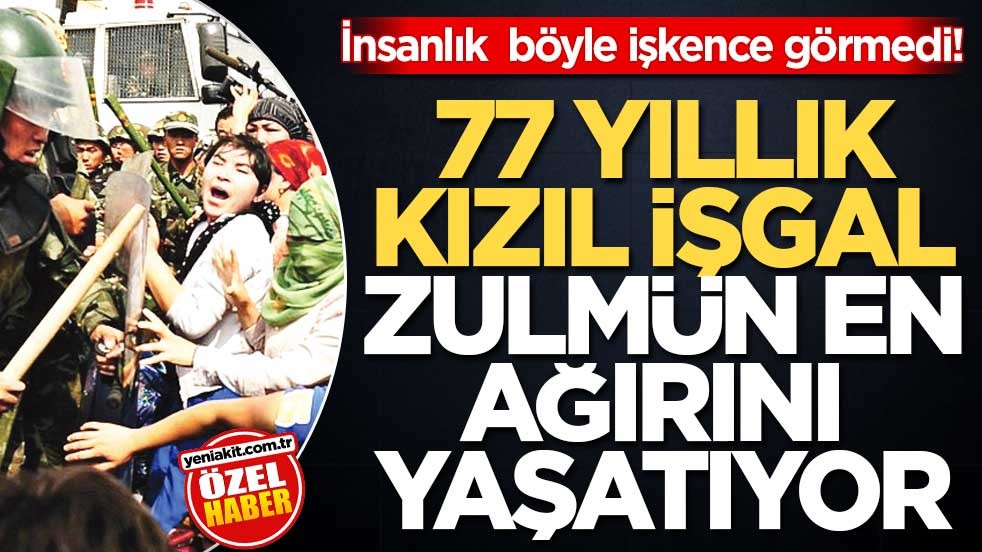 İnsanlık böyle işkence görmedi!