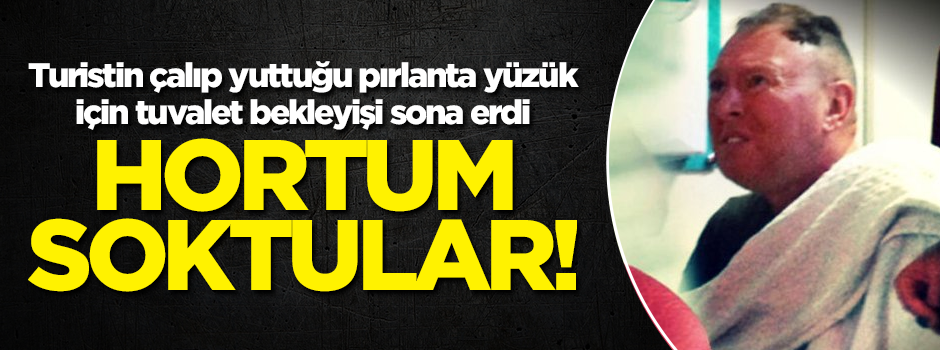 İrlandalı turistin yuttuğu pırlanta yüzük kolonoskopi ile çıkarıldı