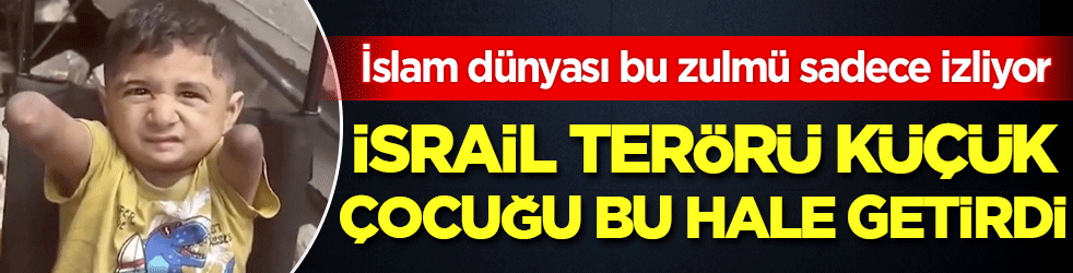 İslam dünyası bu zulmü sadece izliyor: İsrail Terörü küçük çocuğu bu hale getirdi!
