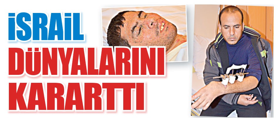 israil dünyalarını kararttı