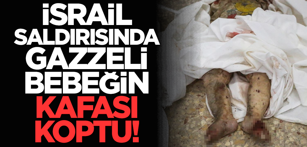 İsrail saldırısında Gazzeli bebeğin kafası koptu!