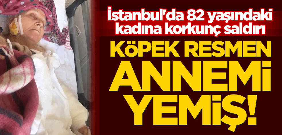 İstanbul'da 82 yaşındaki kadına korkunç saldırı: Köpek resmen annemi yemiş!