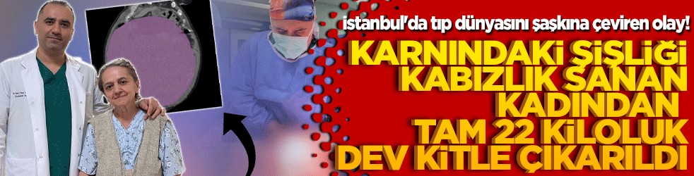 İstanbul'da tıp dünyasını şaşkına çeviren olay! Karnındaki şişliği kabızlık sanan kadından tam 22 kiloluk dev kitle çıkarıldı!