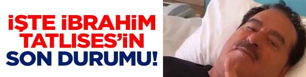 İşte İbrahim Tatlıses’in son durumu! Süreç olumlu devam ederse ameliyat planlanıyor