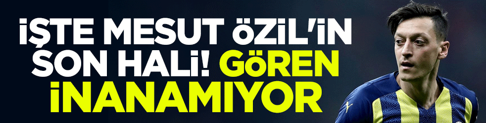 İşte Mesut Özil'in son hali! Gören inanamıyor